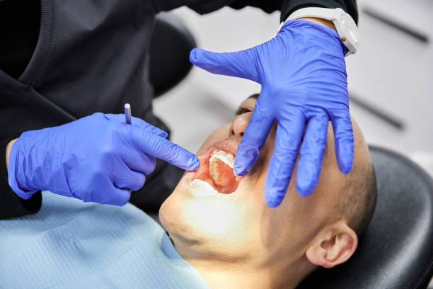 Best Emergency Treatment for Dental Infections or Abscesses in Sandy Springs, SC